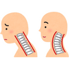 Improves Posture